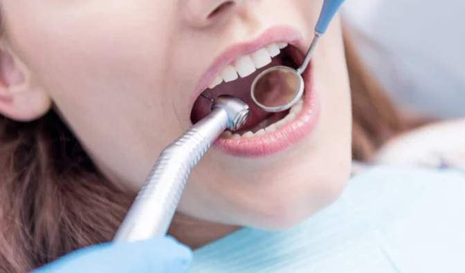 Close-up of a patient's mouth during a dental examination with a mirror and dental scaler in use.