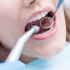 Close-up of a patient's mouth during a dental examination with a mirror and dental scaler in use.